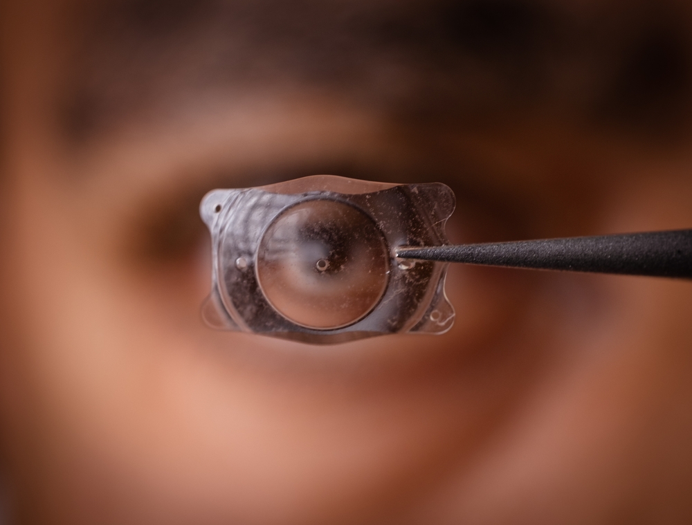 Overview of Visian ICL